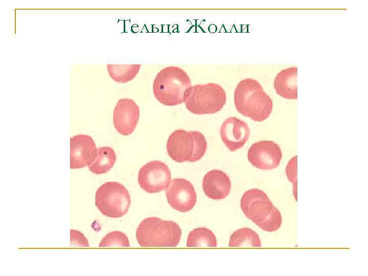 Тельца Жолли 