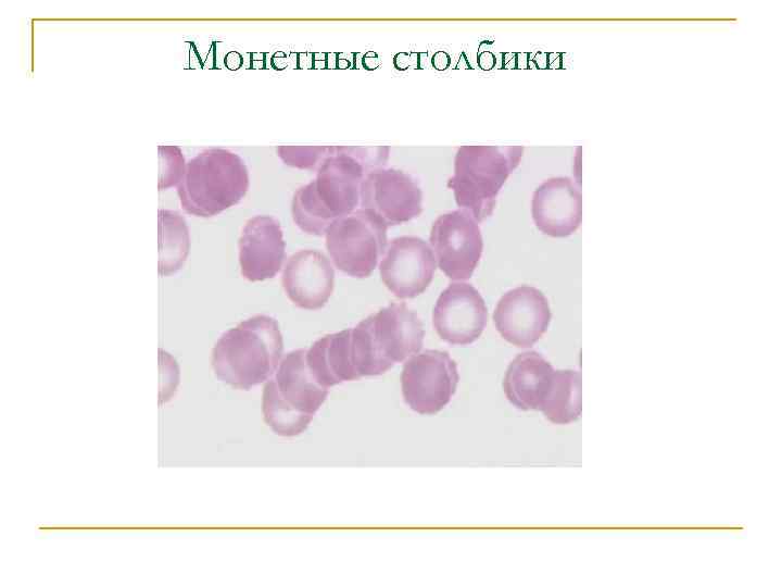 Монетные столбики 