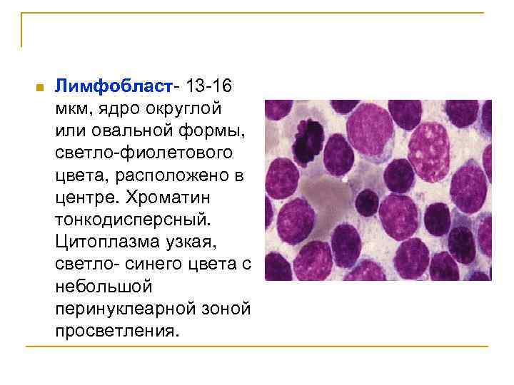 n Лимфобласт- 13 -16 мкм, ядро округлой или овальной формы, светло-фиолетового цвета, расположено в