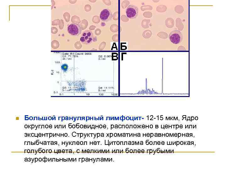 n Большой гранулярный лимфоцит- 12 -15 мкм, Ядро округлое или бобовидное, расположено в центре