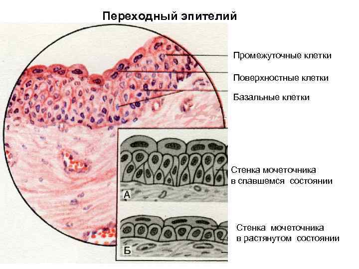 Переходный эпителий Промежуточные клетки Поверхностные клетки Базальные клетки Стенка мочеточника в спавшемся состоянии Стенка