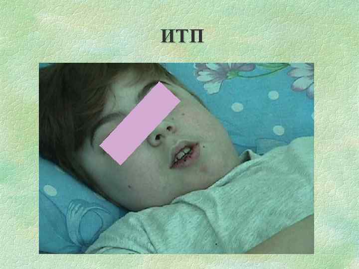 ИТП 
