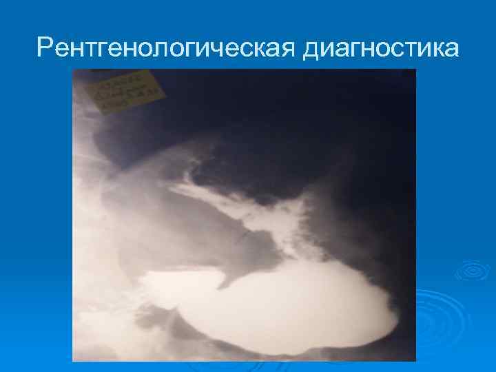 Рентгенологическая диагностика 