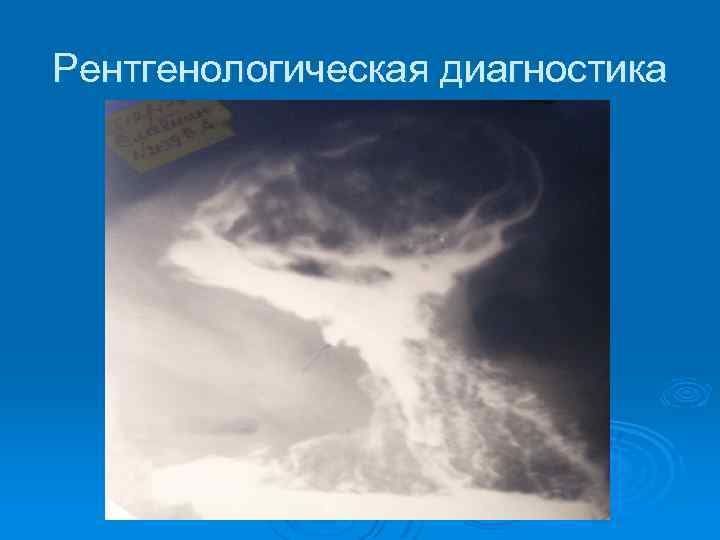 Рентгенологическая диагностика 