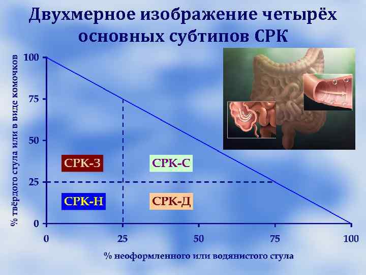 Локализация боли при СРК E. T. Swarbrick et al. Локализация боли при СРК E. T. Swarbrick et al.