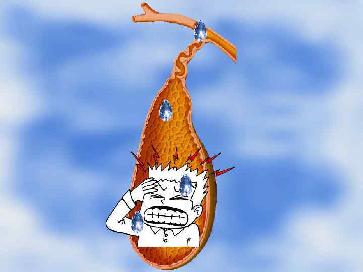 Подтверждающие критерии Боли могут сочетаться с одним или более из следующих симптомов: Подтверждающие критерии Боли могут сочетаться с одним или более из следующих симптомов: