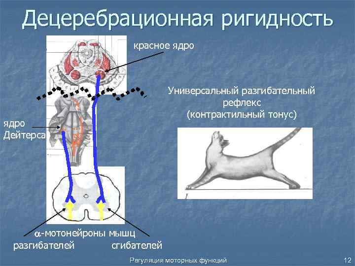 Шкала больших моторных функций