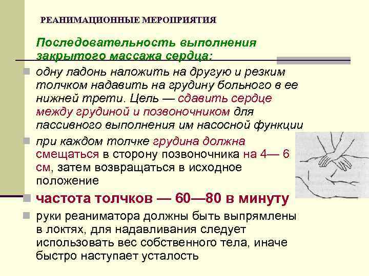 РЕАНИМАЦИОННЫЕ МЕРОПРИЯТИЯ Последовательность выполнения закрытого массажа сердца: n одну ладонь наложить на другую и