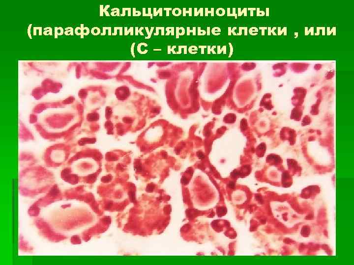 Кальцитониноциты (парафолликулярные клетки , или (С – клетки) 