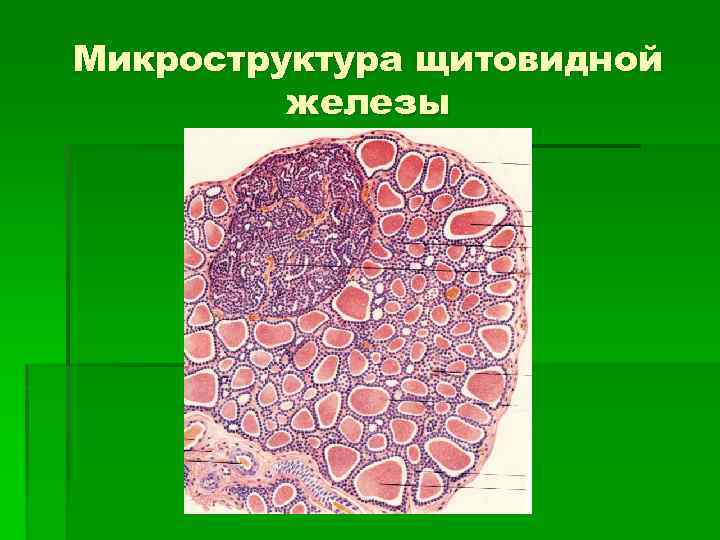 Микроструктура щитовидной железы 