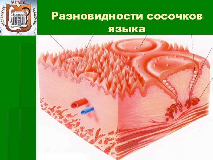 Анальные сосочки увеличенные фото