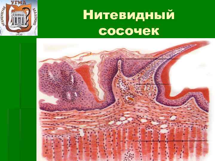 Нитевидные сосочки фото