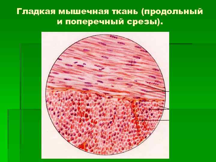 Гладкая ткань. Гладкая мышечная ткань продольный срез. Гладкая и поперечная мышечная ткань. Гладкая мышечная ткань поперечный срез. Срез гладкой мышечной ткани.