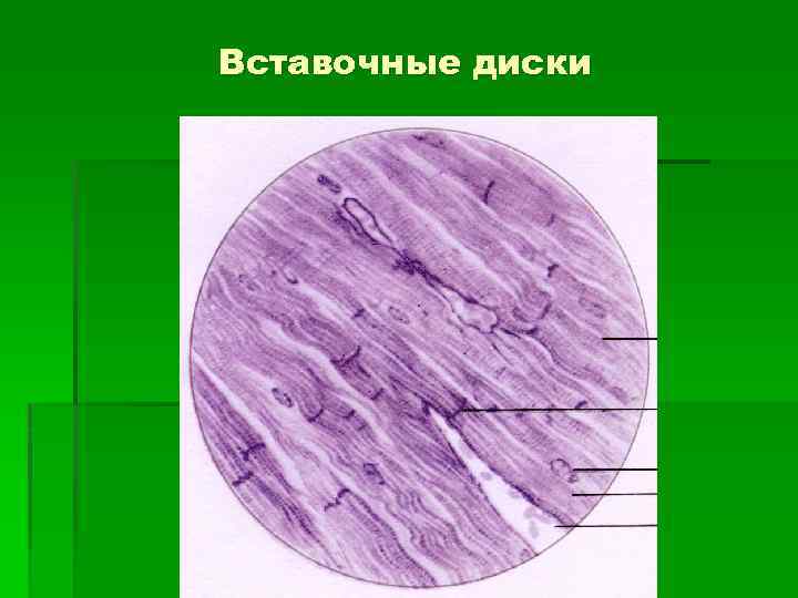 Схема строения вставочного диска