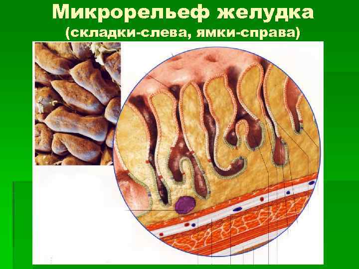 Микрорельеф желудка (складки-слева, ямки-справа) 