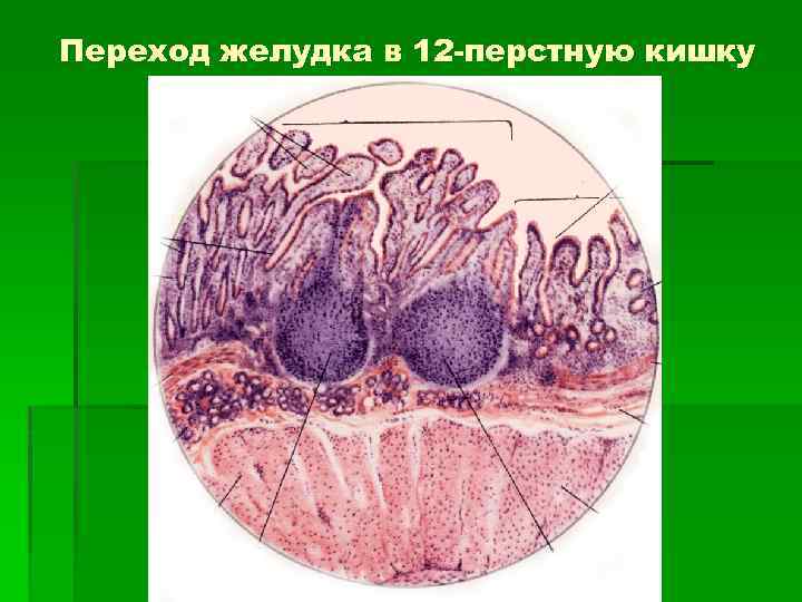 Переход желудка в 12 -перстную кишку 