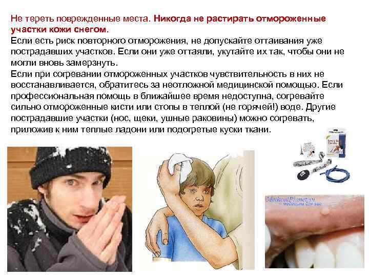 Не тереть поврежденные места. Никогда не растирать отмороженные участки кожи снегом. Если есть риск