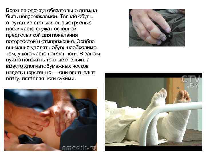 Верхняя одежда обязательно должна быть непромокаемой. Тесная обувь, отсутствие стельки, сырые грязные носки часто