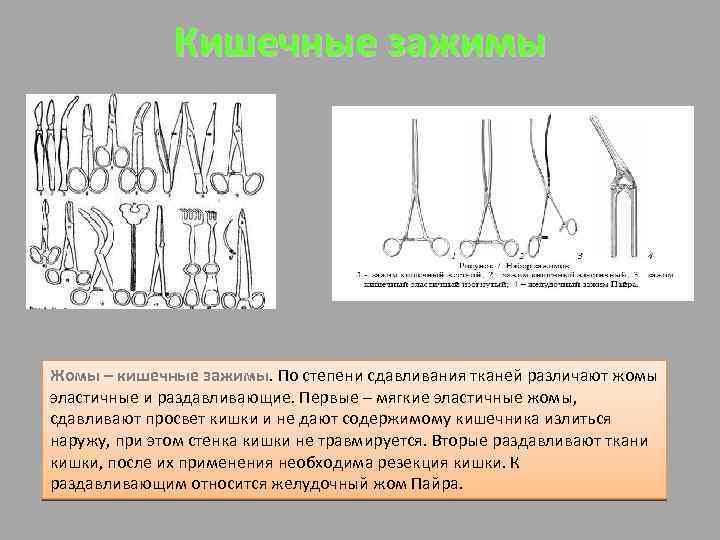Кишечные зажимы Жомы – кишечные зажимы. По степени сдавливания тканей различают жомы эластичные и