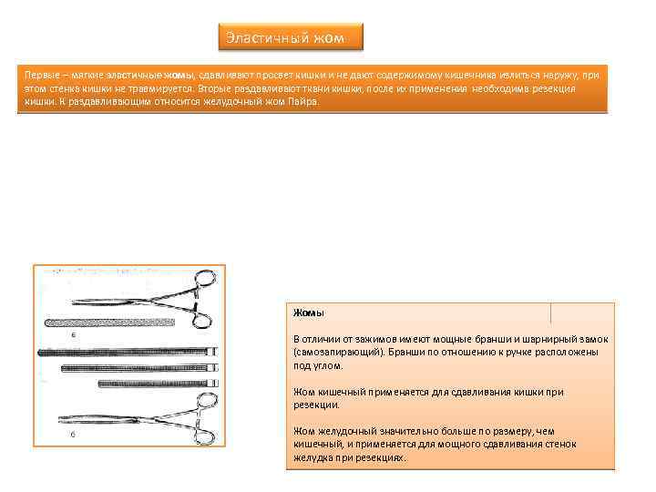Эластичный жом Первые – мягкие эластичные жомы, сдавливают просвет кишки и не дают содержимому