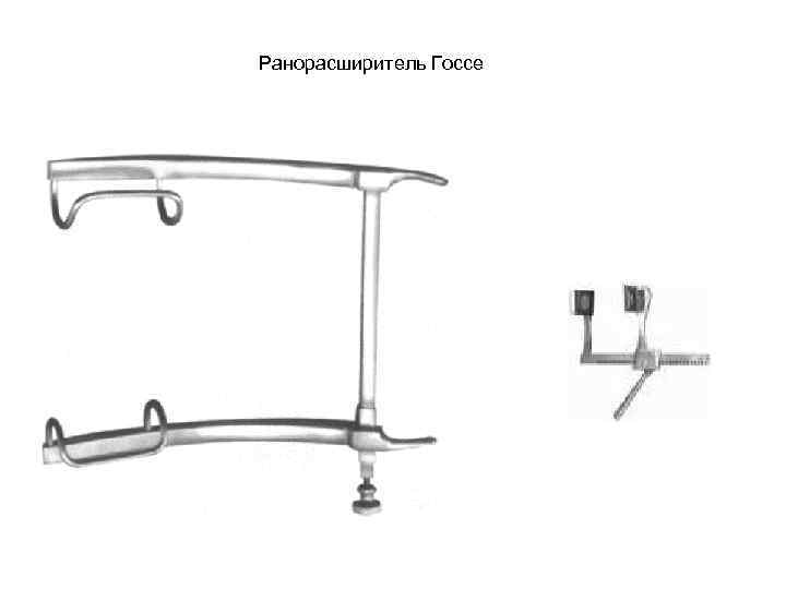 Ранорасширитель Госсе 
