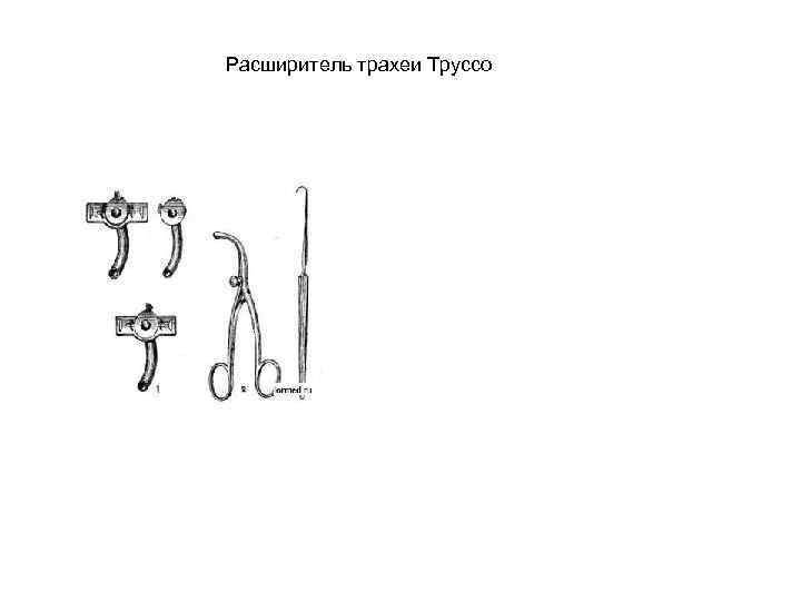 Ранорасширитель труссо фото