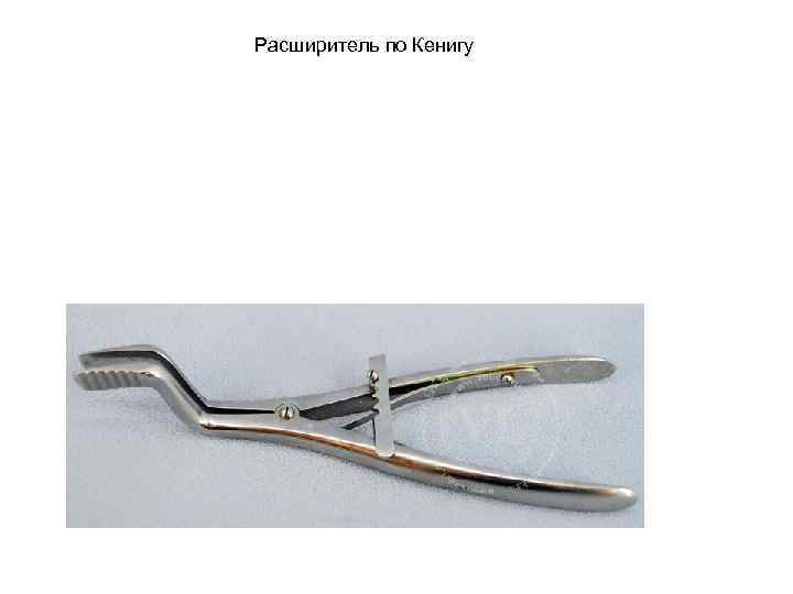 Расширитель по Кенигу 