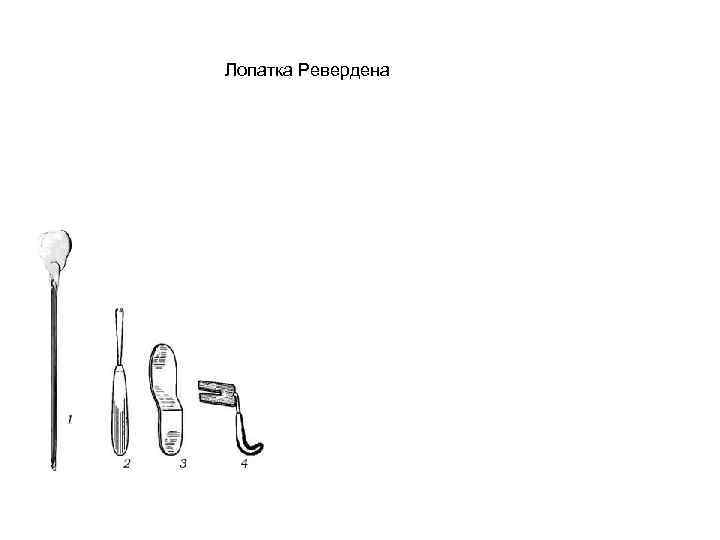 Лопатка Ревердена 