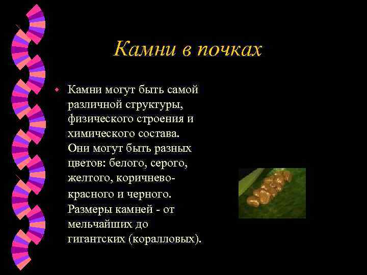 Камни в почках w Камни могут быть самой различной структуры, физического строения и химического