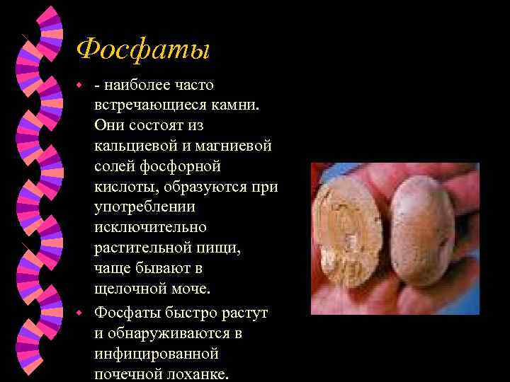 Фосфаты - наиболее часто встречающиеся камни. Они состоят из кальциевой и магниевой солей фосфорной