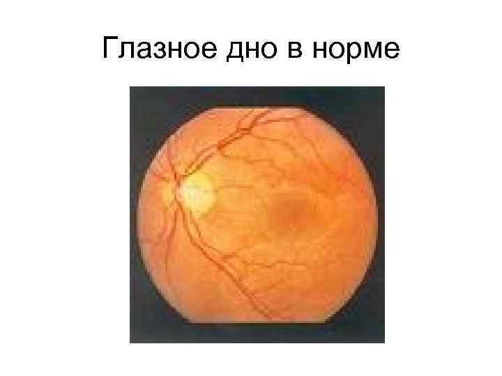 Глазное дно в норме 