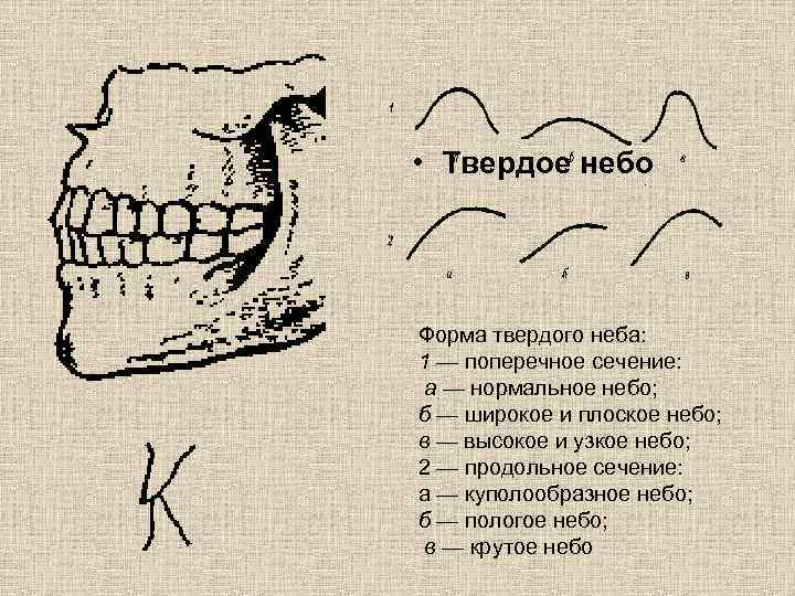 Высокий твердый. Готическая форма твердого неба. Формы строения твердого неба. Твердое небо куполообразной формы.