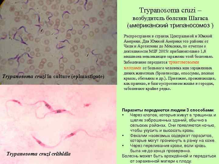 Trypanosoma cruzi – возбудитель болезни Шагаса (американский трипаносомоз ) Trypanosoma cruzi in culture (epimastigote)