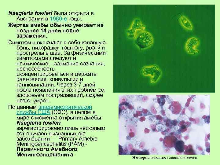 Naegleria fowleri была открыта в Австралии в 1960 -е годы. Жертва амебы обычно умирает