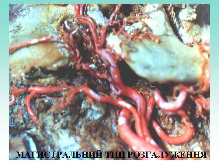 МАГИСТРАЛЬНИЙ ТИП РОЗГАЛУЖЕННЯ 