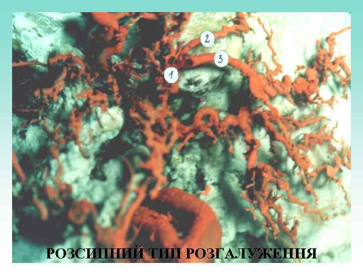 РОЗСИПНИЙ ТИП РОЗГАЛУЖЕННЯ 