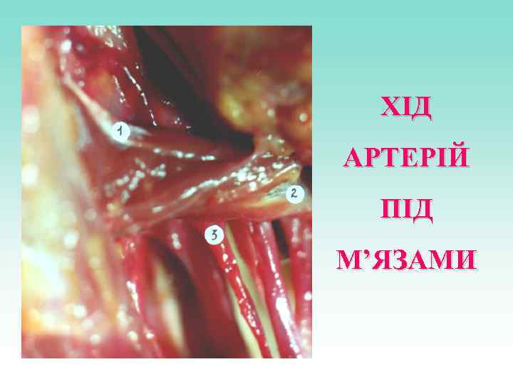 ХІД АРТЕРІЙ ПІД М’ЯЗАМИ 