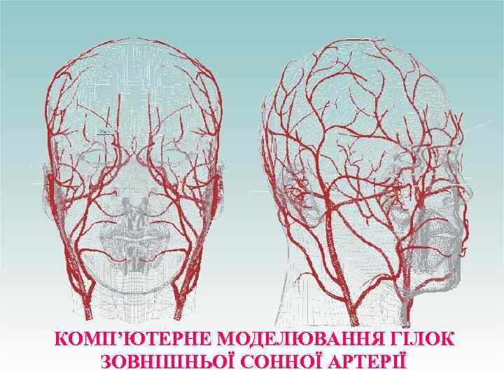 КОМП’ЮТЕРНЕ МОДЕЛЮВАННЯ ГІЛОК ЗОВНІШНЬОЇ СОННОЇ АРТЕРІЇ 
