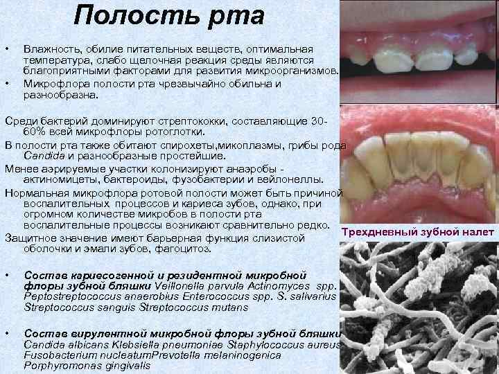 Полость рта • • Влажность, обилие питательных веществ, оптимальная температура, слабо щелочная реакция среды
