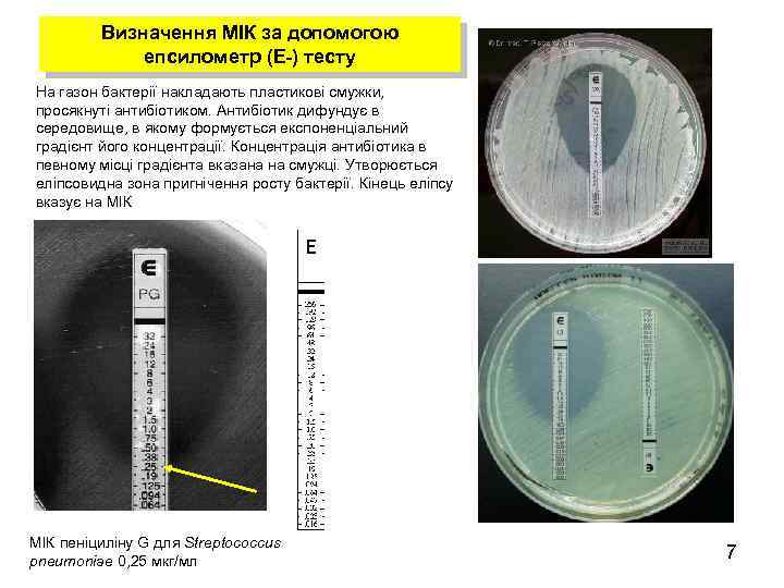 Визначення МІК за допомогою епсилометр (Е-) тесту На газон бактерії накладають пластикові смужки, просякнуті