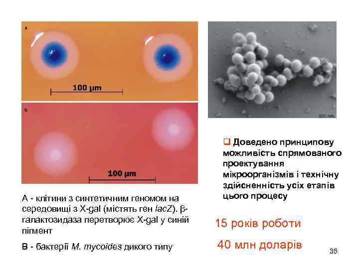 А - клітини з синтетичним геномом на середовищі з X-gal (містять ген lac. Z).