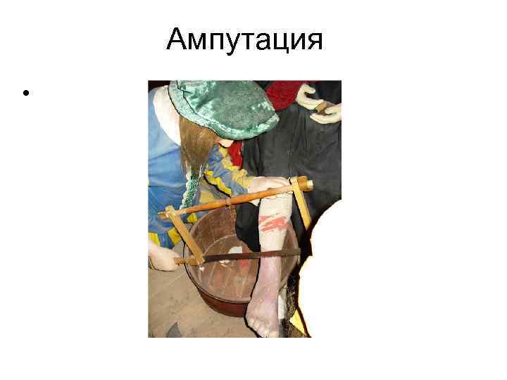 Ампутация • 