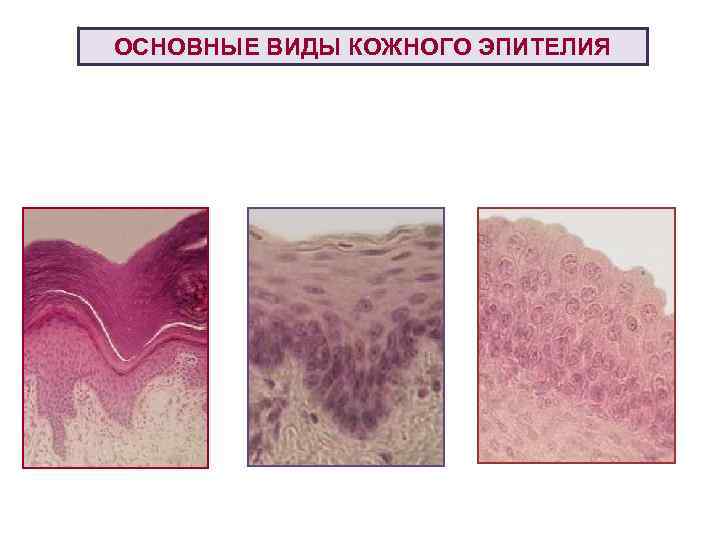 ОСНОВНЫЕ ВИДЫ КОЖНОГО ЭПИТЕЛИЯ 