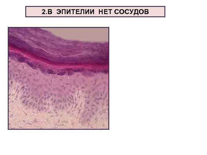 2. В ЭПИТЕЛИИ НЕТ СОСУДОВ 