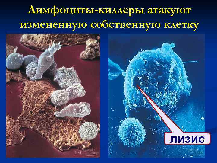 Лимфоциты-киллеры атакуют измененную собственную клетку лизис 