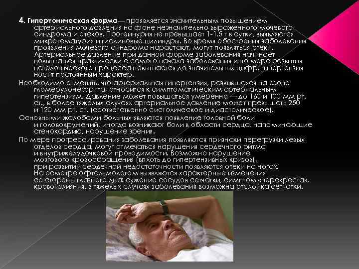 4. Гипертоническая форма— проявляется значительным повышением артериального давления на фоне незначительно выраженного мочевого синдрома