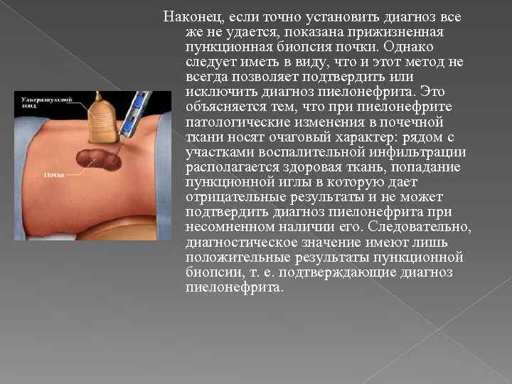 Наконец, если точно установить диагноз все же не удается, показана прижизненная пункционная биопсия почки.