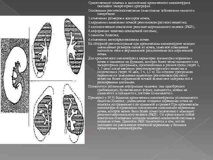 Существенную помощь в диагностике хронического пиелонефрита оказывает экскреторная урография. Основными рентгенологическими симптомами заболевания являются