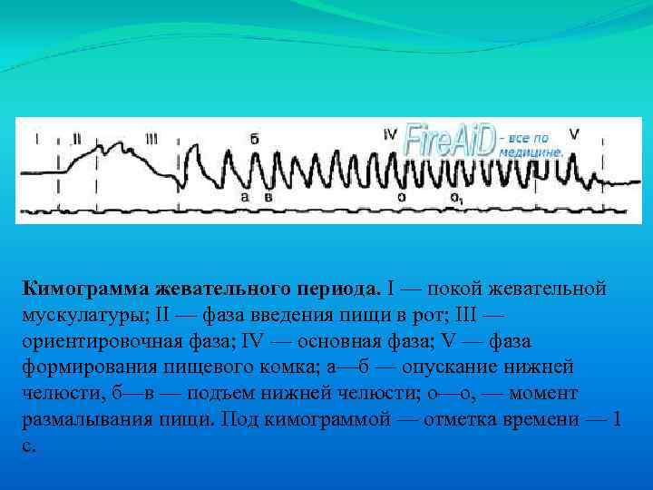 Кимограмма жевательного периода. I — покой жевательной мускулатуры; II — фаза введения пищи в