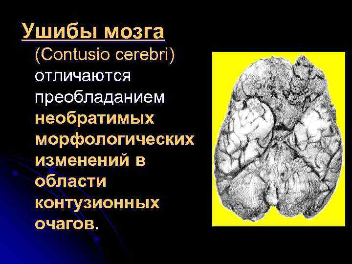 Ушибы мозга (Contusio cerebri) отличаются преобладанием необратимых морфологических изменений в области контузионных очагов. 